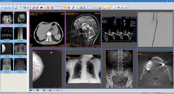 Sante DICOM Editor(DICOM编辑器)